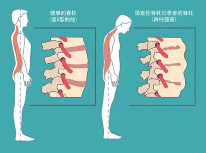 “我米乐 M6米乐想平视家人的眼睛说话”(图5)